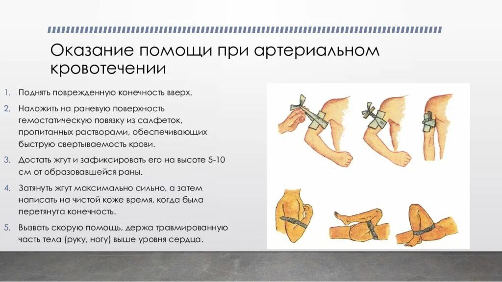 Правила оказания первой при кровотечении. Оказание первой медицинской помощи при артериальном кровотечении. Поврежденную конечность при артериальном кровотечении. Оказание ПМП при артериальном кровотечении. Алгоритм оказания первой помощи при артериальном кровотечении.