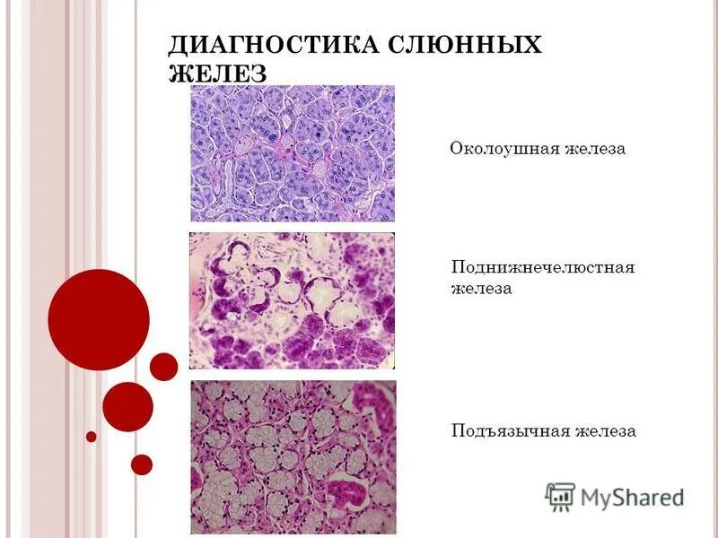 Препарат околоушной железы. Подчелюстная железа гистология препарат. Околоушная железа гистология препарат. Слюнные железы гистология препарат. Подъязычная железа гистология.