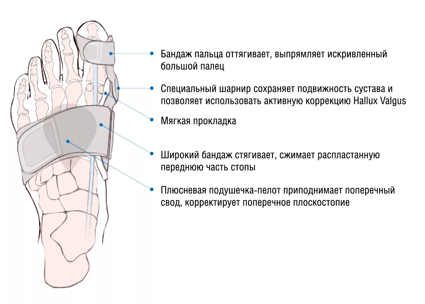 Почему болит палец на правой ноге