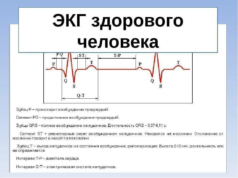 Норма длительности экг. Расшифровка экг показатели нормы таблица. отрицательный зубец р после qrs комплекса. расшифровка экг сердца у взрослого человека норма. норма qrs на экг у взрослых таблица.