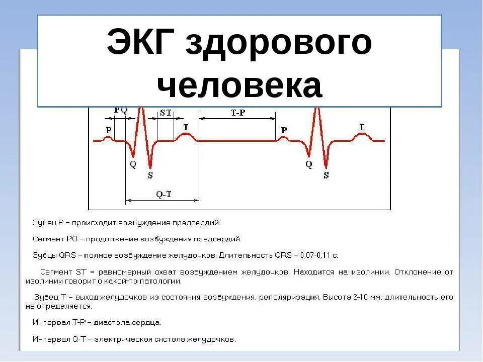 Нарастание зубца. Норма ЭКГ расшифровка кардиология. Расшифровка ЭКГ показатели нормы таблица. Отрицательный зубец р после QRS комплекса. Расшифровка ЭКГ сердца у взрослого человека норма.