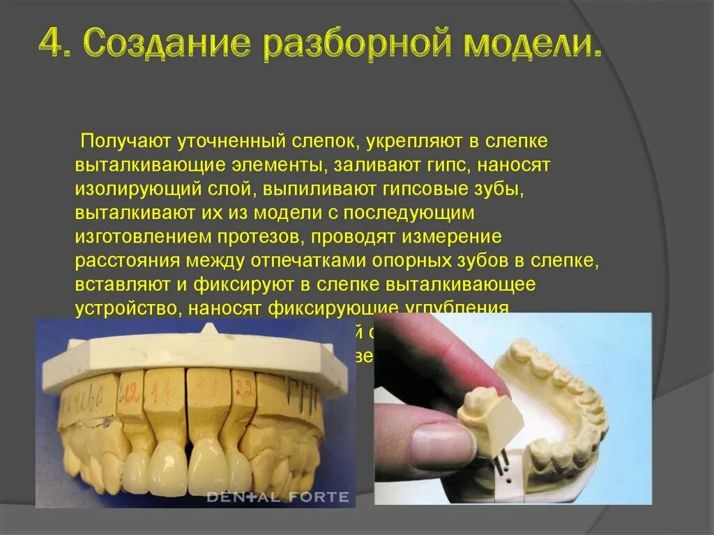 Гипсовая модель зубов. Изготовление комбинированной разборной модели. Разборная модель. Получение разборной модели. Лабораторные этапы металлокерамической коронки