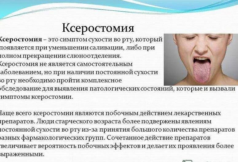 Ощущение сухости. Сухость во рту симптом заболеваний. факторы сухости во рту. причины сухости во рту причин.
