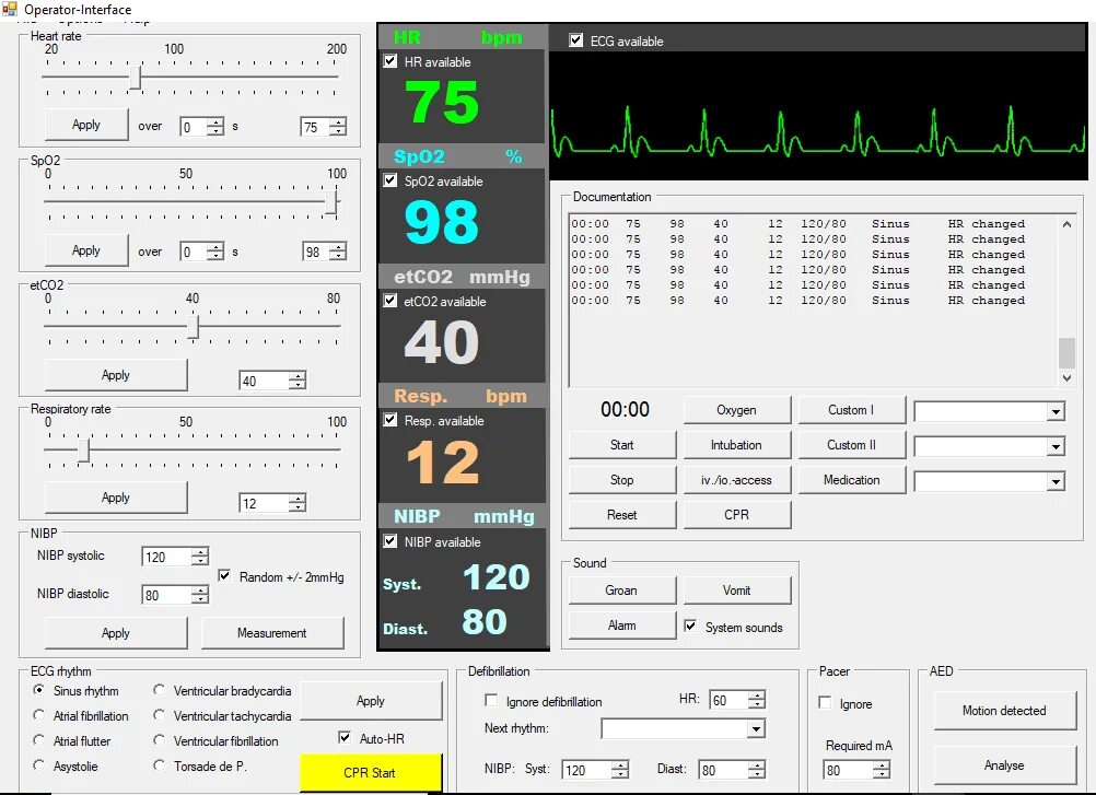 Интерфейс оператора. ECG симулятор. Программные симуляторы программа. Интерфейс программы для оператора. Программный симулятор станция организатора ответы 2024