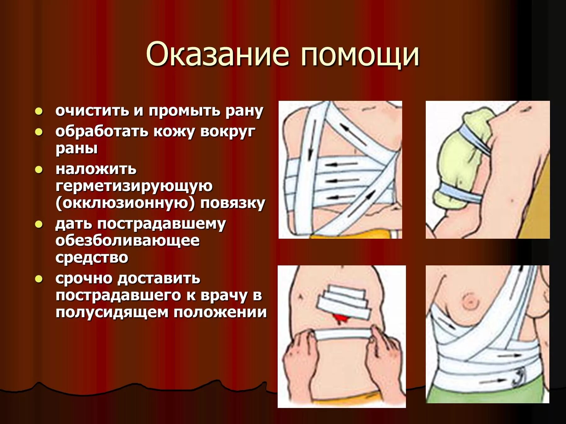 Наложение окклюзионной повязки при пневмотораксе. Герметичная окклюзионная повязка. Герметическая повязка на грудную клетку. Обработка кожи вокруг раны. Герметизирующая повязка накладывается при.