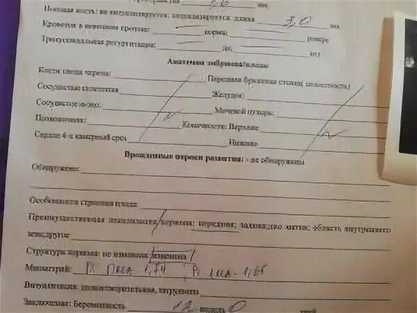 пульсационный индекс в венозном протоке 12 недель. первый скрининг при беременности сроки. пульсационный индекс в венозном протоке 12 недель. пульсационный индекс в венозном протоке 12 недель. венозный проток pi норма.