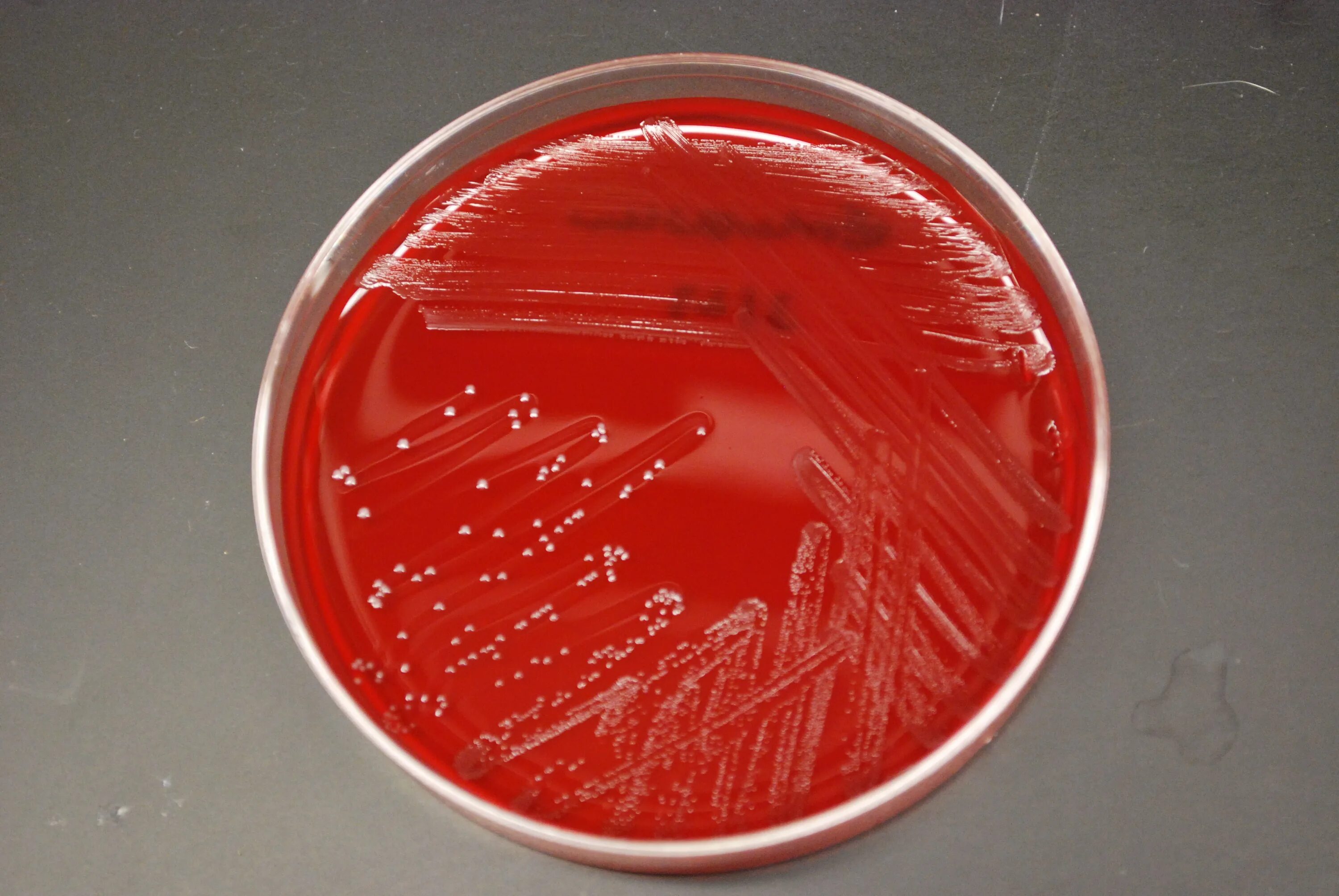 Enterococcus faecalis