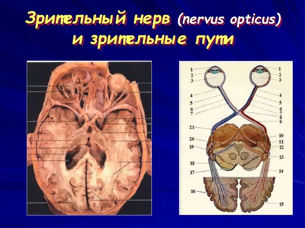 Зрительный нерв. Зрительные нервы. Зрительный нерв (nervus Opticus). Анатомия зрител ног нерва. Два зрительных нерва