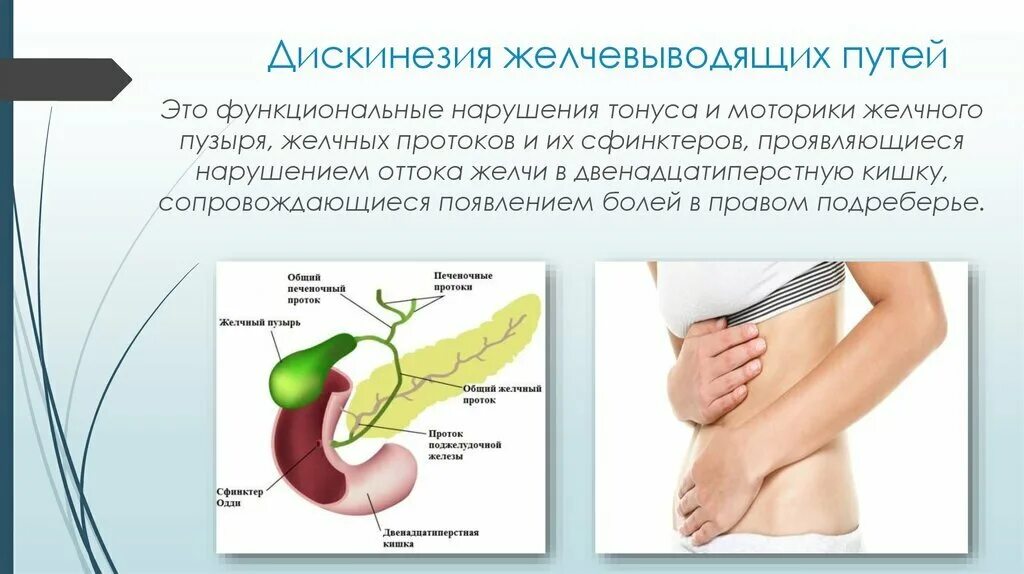 Заболеваний желчевыводящих. Нарушение функций желчевыводящих путей. Нарушение моторики желчевыводящих путей. Дискинезия желчевыводящих путей симптомы. Дискинезия желчного пузыря.