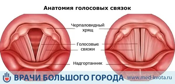 Поврежденные голосовые связки. Больные голосовые связки. Рыхлые голосовые связки. Воспаленные голосовые связки.