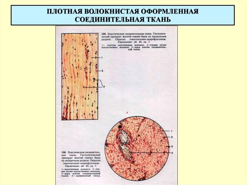 Плотная оформленная ткань. Плотная волокнистая соединительная ткань эластического типа. Плотная оформленная соединительная ткань эластическая связка. Плотная волокнистая соединительная ткань поперечный срез. Плотная оформленная соединительная ткань с эластическими волокнами.