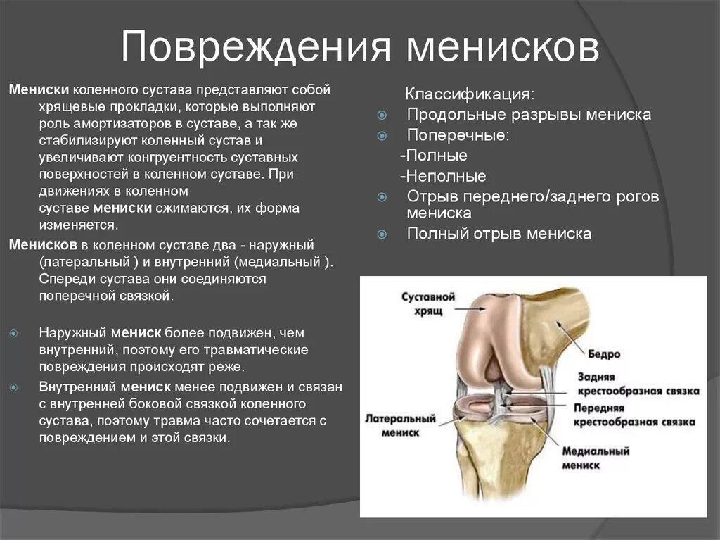 Травма мениска коленного сустава симптомы. Повреждение менисков коленного сустава классификация. Разрыв наружного мениска коленного сустава симптомы. Повреждение мениска колена симптомы. Коленный сустав производители