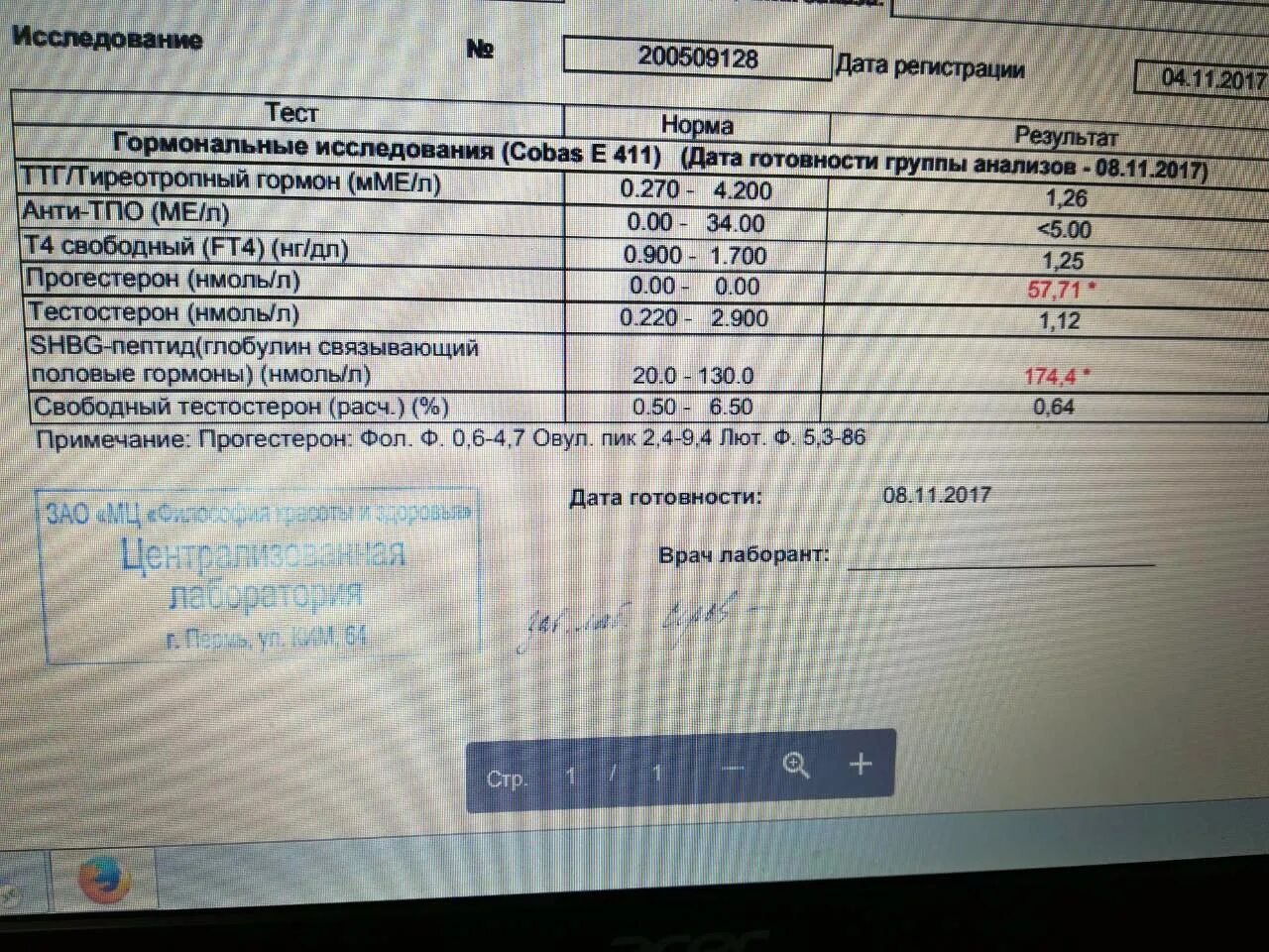 Ттг повышен анти тпо повышены. Анти ТПО. Анти ТПО расшифровка. Повышенное анти ТПО что это. Нормы анти тг и анти ТПО.