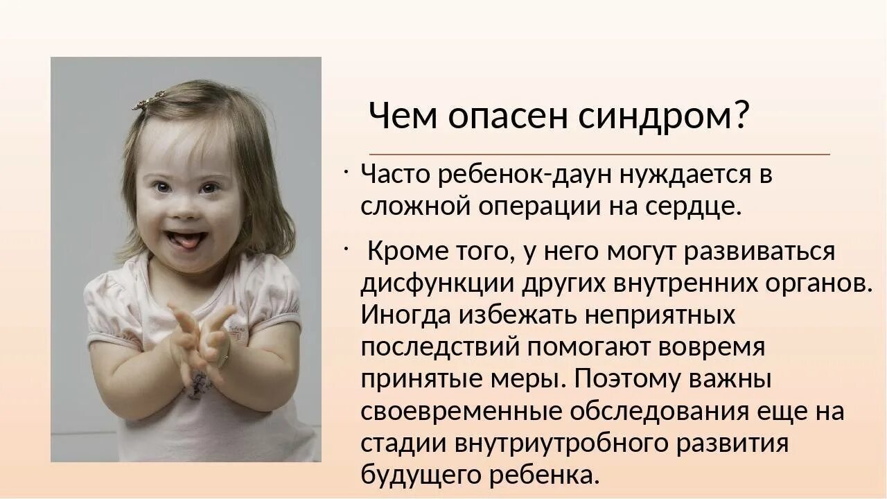 Фенотип ребенка с синдромом дауна. Синдром Дауна.