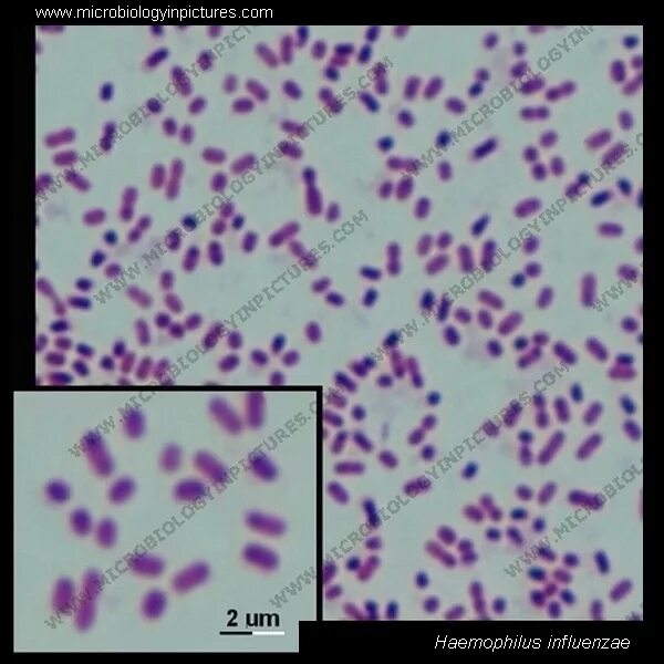 Haemophilus в мазке у мужчин. Гемофильная палочка микроскопия. Гемофильная палочка капсула. Haemophilus influenzae морфология. Гемофильная палочка токсины.