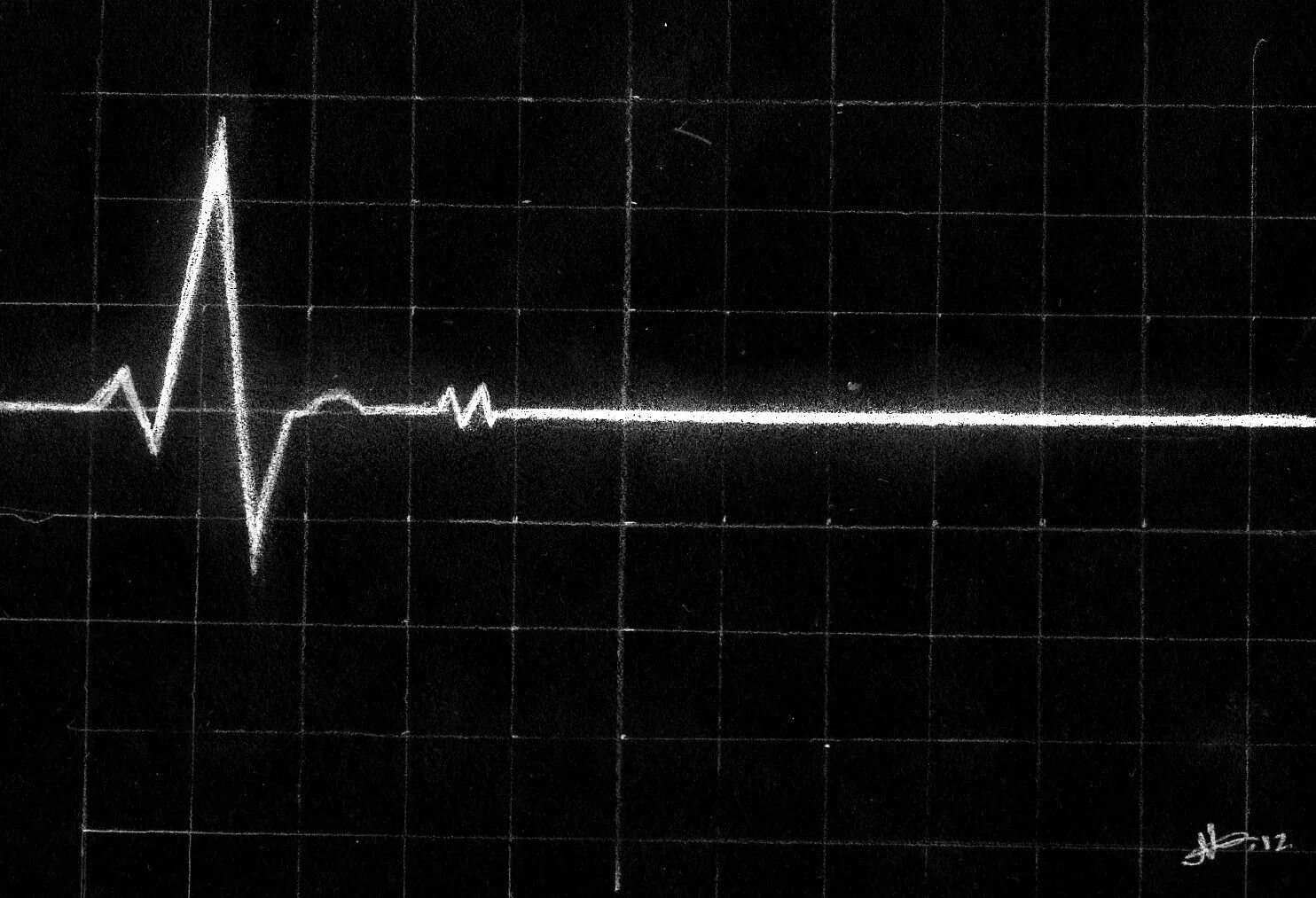 Пульс на лбу. Кардиограмма остановки сердца. Линия биения сердца. Прямая линия на кардиограмме. Сердце остановилось.