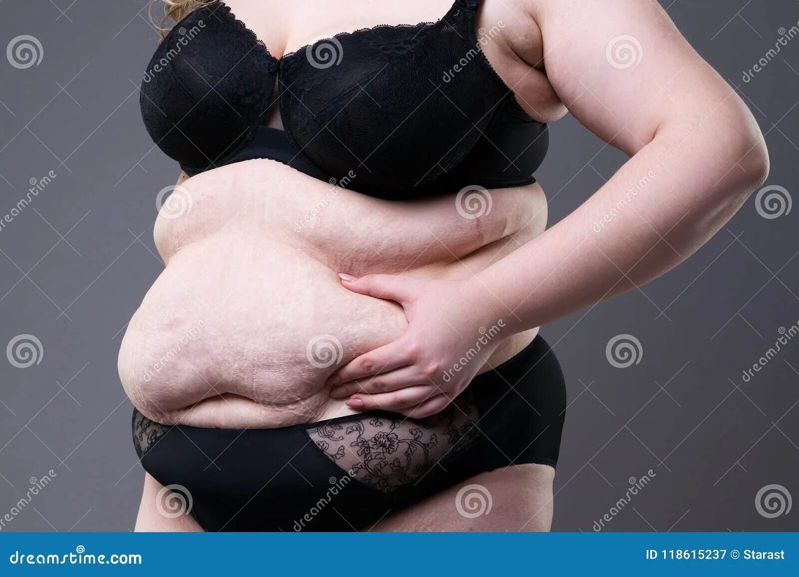 Большой живот у женщин ожирение. Толстое пузо у женщин от еды. Очень жирный живот