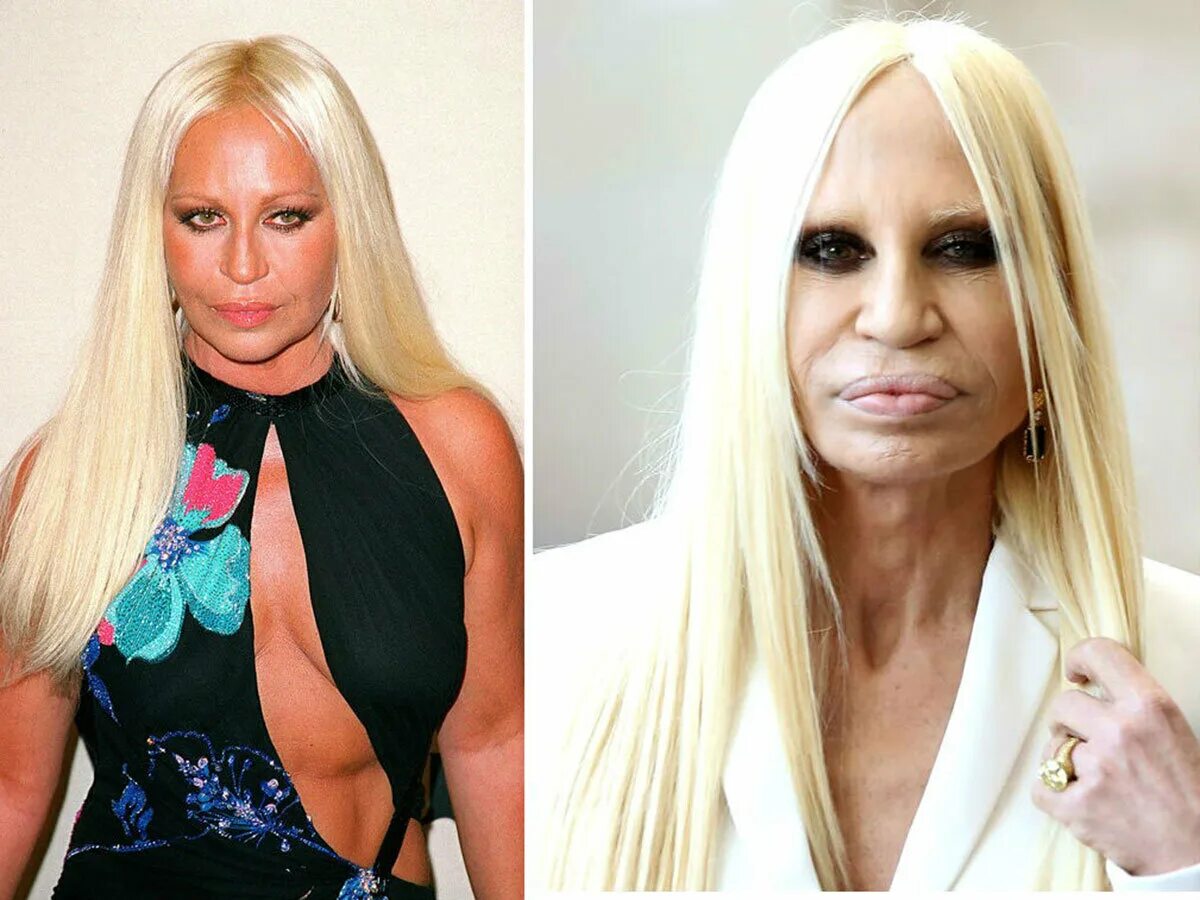 Donatella Versace до пластики. Донателла Версаче до операции. Донателла Версаче 2020. Донателла Версаче пластика. Форум пластических операций