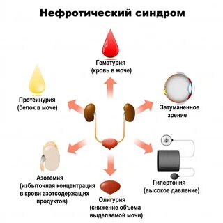 Нефрит гематурия