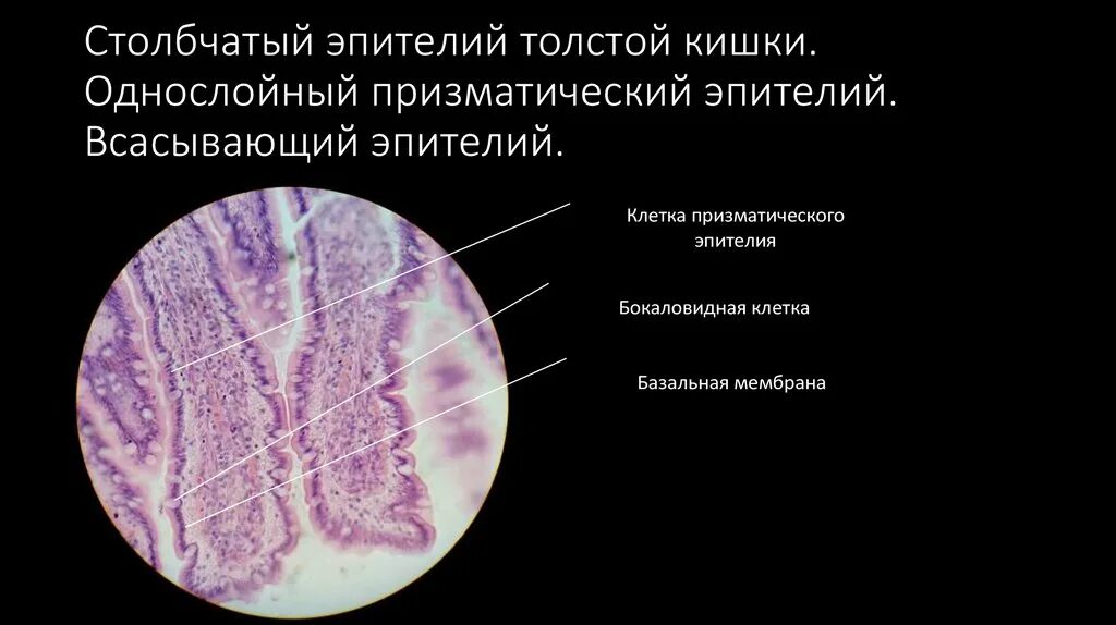Однослойный призматический железистый эпителий желудка. Собственная пластинка слизистой оболочки желудка. Однослойный цилиндрический (призматический) эпителий. Пилорический отдел желудка гематоксилин эозин. Слизистая оболочка желудка гистология.