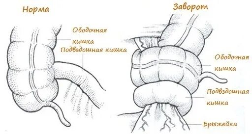 От чего может быть заворот. Заворот тонкой кишки операции. заворот тонкого кишечника. заворот кишечника у собак симптомы. заворот кишечника у животных.