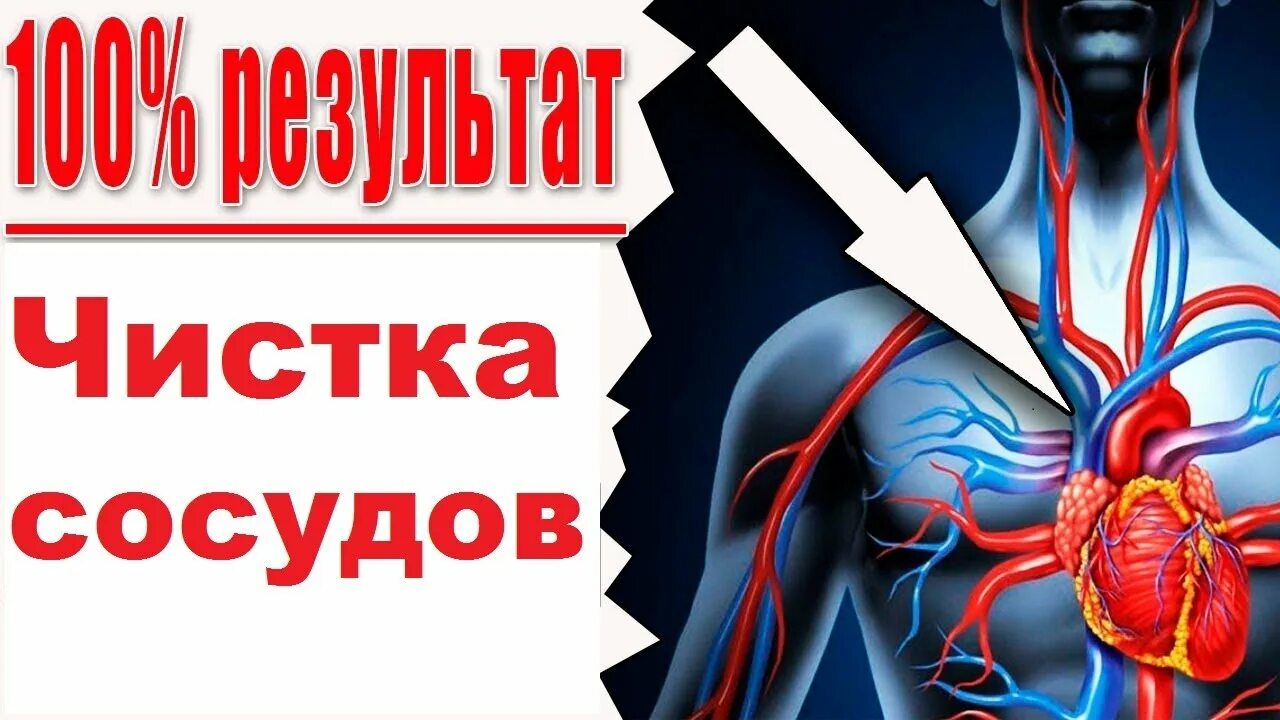 Прочистка сосудов. Неумывакин очищение сосудов. Чистка сосудов по Неумывакину. Очищение сосудов головного мозга. Неумывакин чистка сосудов чесноком и лимоном.