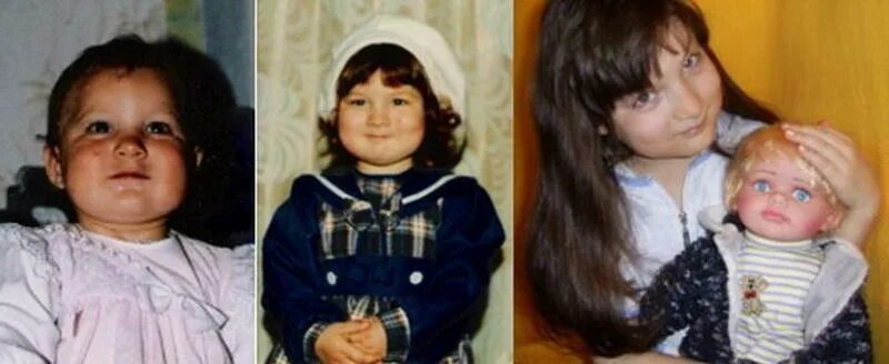 Ребенок до и после. Дети до и после усыновления. Дети из детдома до и после усыновления. Фото детей до и после усыновления.