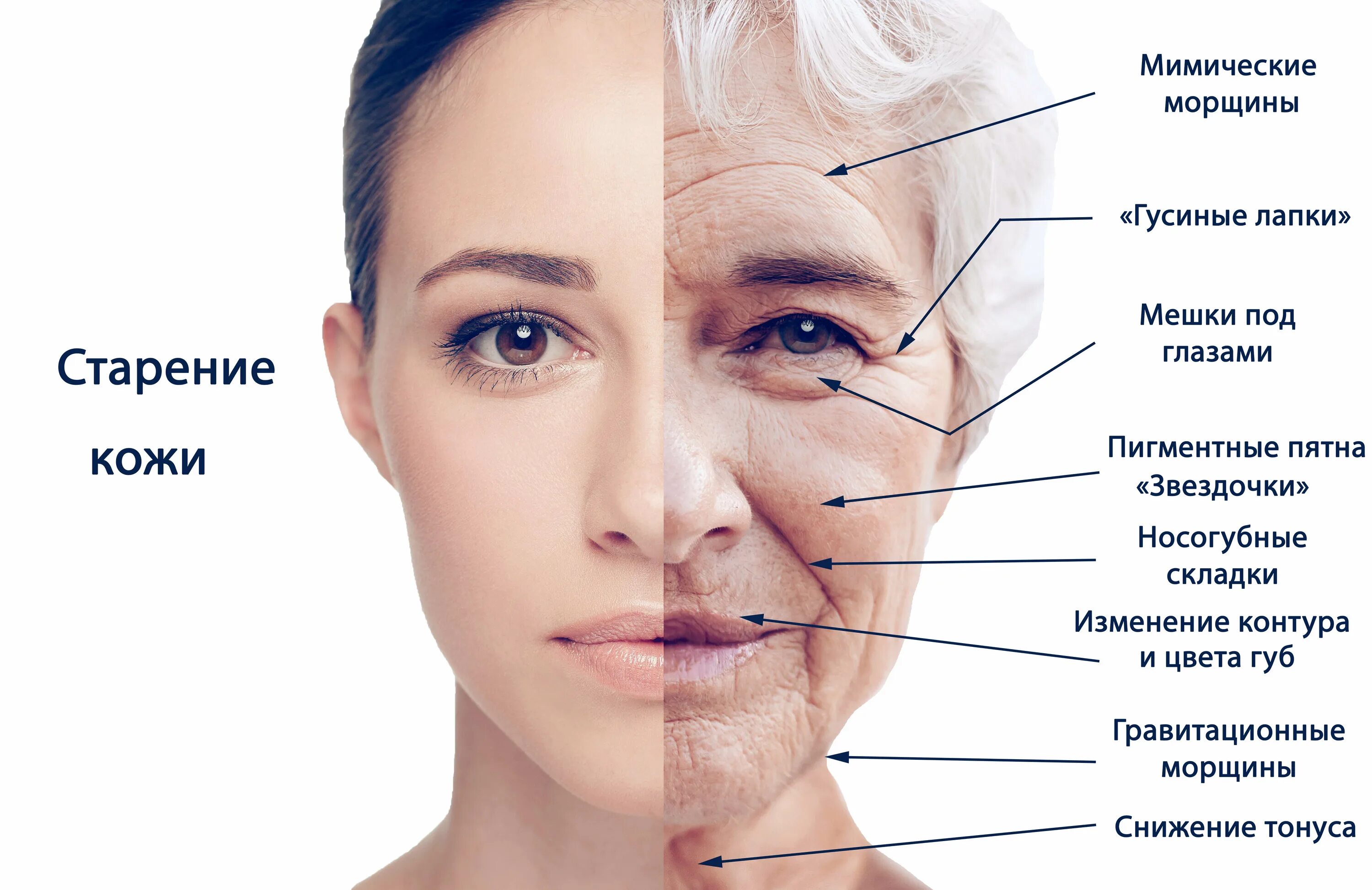 Признаки старения. Старение кожи лица. Возрастные изменения кожи лица. Признаки старения лица.