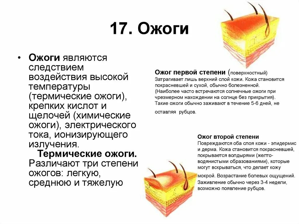 Химический ожог легких. Солнечный ожог 2 и 3 степени. Солнечные ожоги 1 и 2 степени. Химический ожог 1 степени.