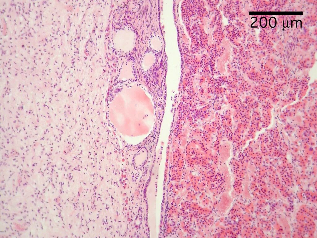 Питуициты гипофиза гистология. Передняя доля гипофиза гистология. Гипофиз человека гистология препарат. Препарат гипофиз гистология малори. Нейрогипофиз гистология.