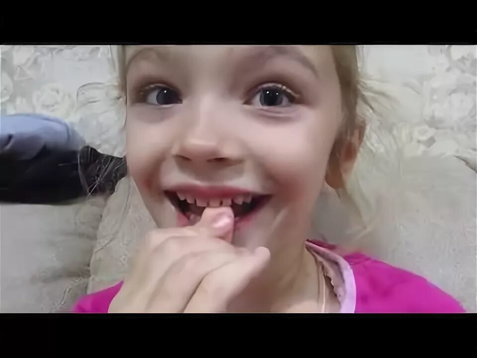 Сам выдираю зубы