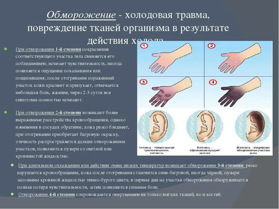 Общее повреждение организма. Обморожения 1,2,3 степени первая помощь. Первая помощь при обморожении 3 степени. Термические поражения .термические ожоги .холодовая травма. Помощь при 3 степени обморожения.