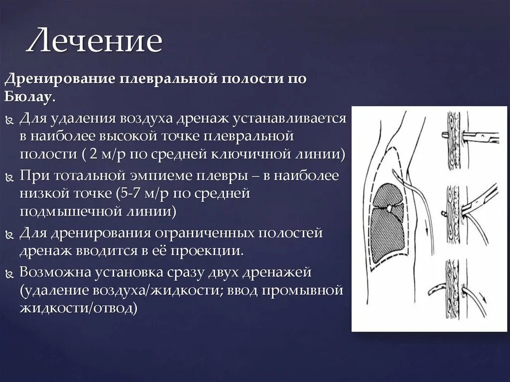 Лечение плевральной полости. Пассивная аспирация по Бюлау. Дренаж при эмпиеме плевры. Методика дренирования плевральной полости.