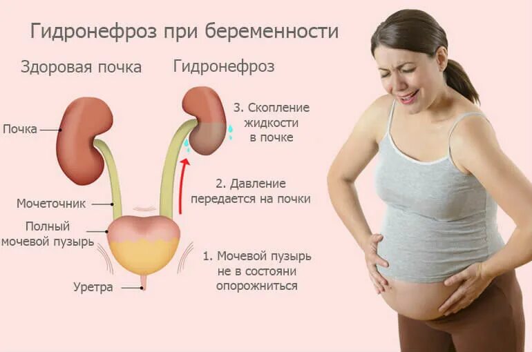 Почему болит живот и матка