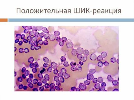 Па реакция