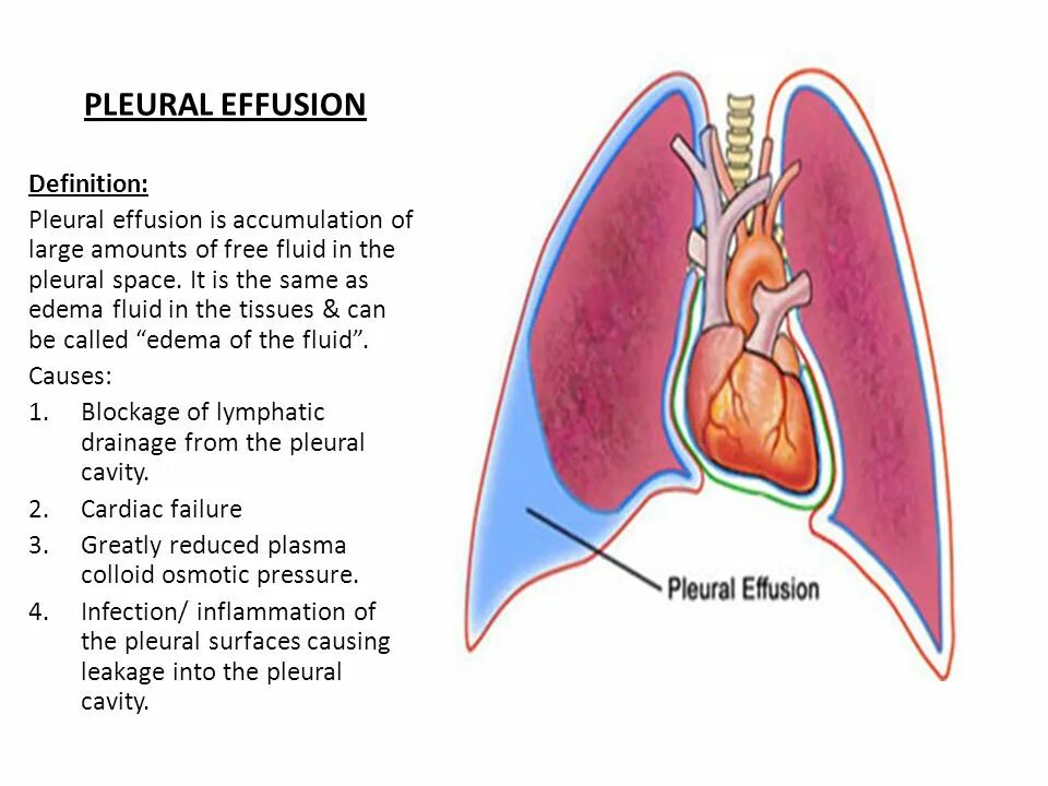 Эмпиема латынь. Pleural Effusion. Pleural Effusion Laboratory.