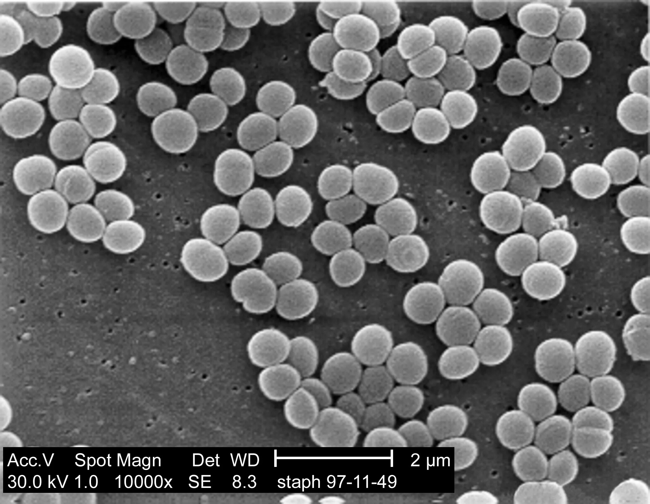 Микроорганизм staphylococcus aureus. Стафилококк ауреус микроскопия. стафилококк золотистый staphylococcus aureus. галофилы стафилококки. бактерия стафилококк ауреус.