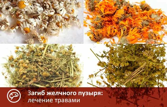 Препараты при загибе желчного пузыря. Лечение загиба желчного пузыря травами. загиб желчного пузыря лекарства. при загибе желчного пузыря. травы при перегибе желчного пузыря.