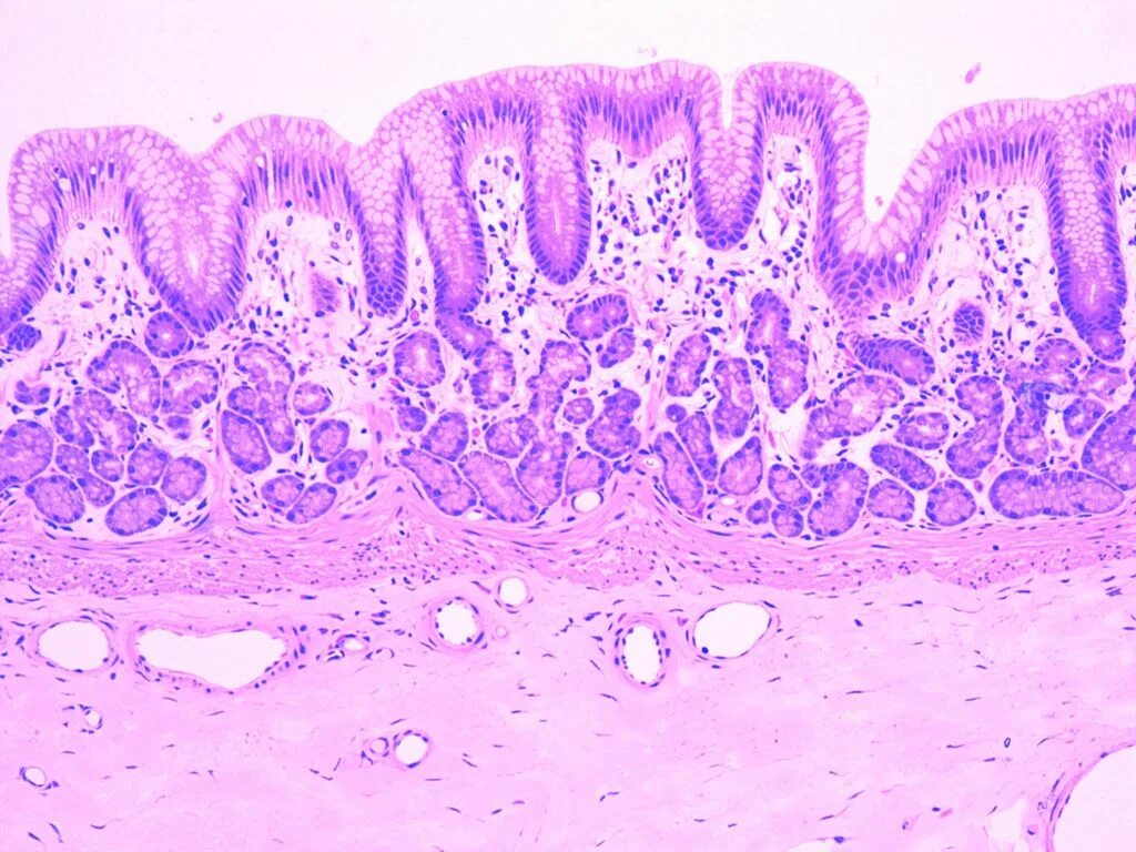 Тонкая кишка гистология препарат. Железы толстой кишки гистология. Слизистая оболочка желудка гистология. Эпителий желудка гистология. Барьер слизистая оболочка