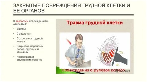 У женщины ушиб грудной клетки
