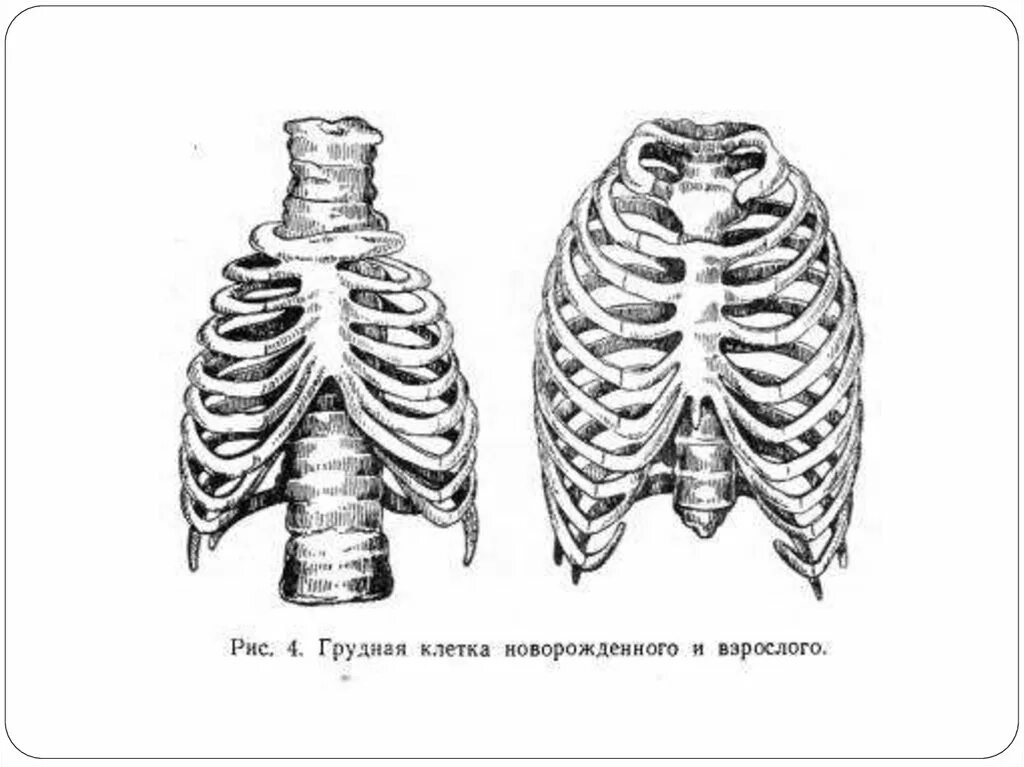 Грудная клетка ребенка 2 года. Бочковидная грудная клетка у новорожденного. Грудная клетка новорожденного анатомия. Бочкообразная грудная клетка у младенца. Бочкообразная форма грудной клетки у грудничка.