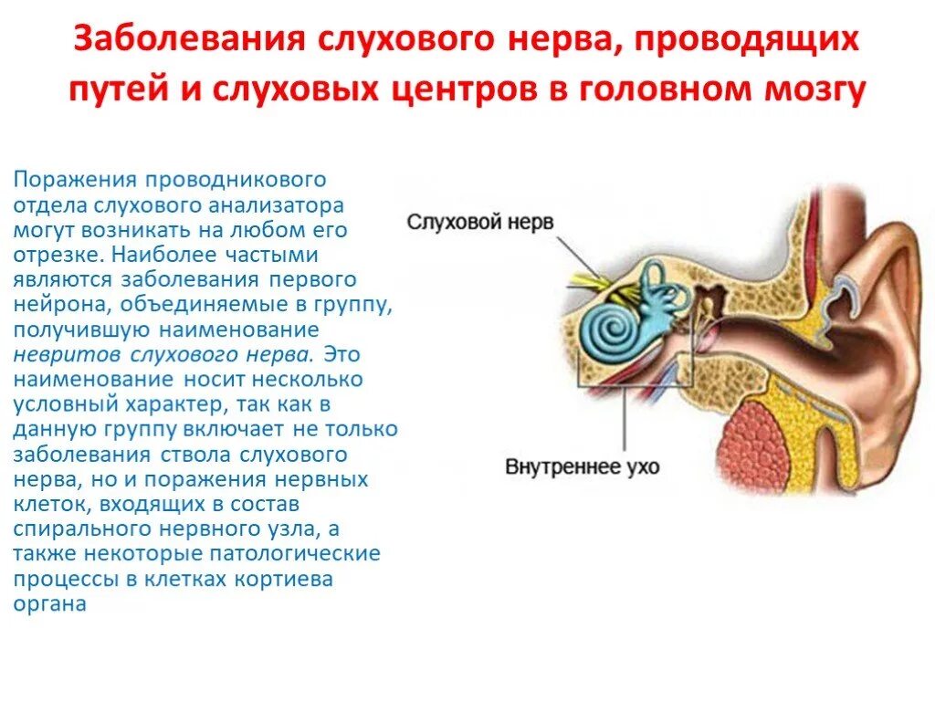 Заболевания проводникового отдела слухового анализатора. Поражения проводникового отдела слухового анализатора. Строение слухового анализатора нервы. Строение уха слуховой нерв. Верные признаки органов слуха человека