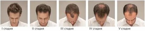 Стадии мужчин