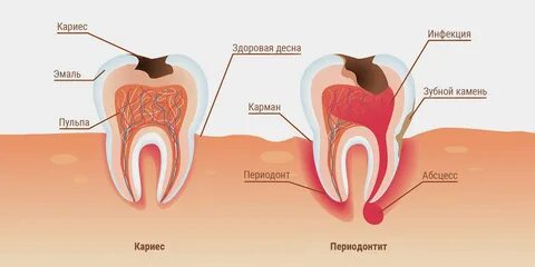 В зубе кто то есть