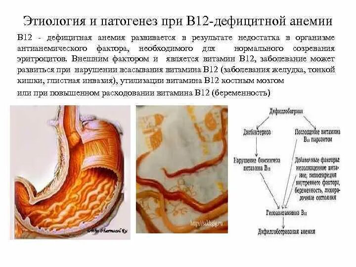 Резекция желудка анемия. Механизм развития в12 дефицитной анемии. Патогенез дефицита витамина в12. Патогенез б12 дефицитной анемии кратко. Б12 анемия этиология.