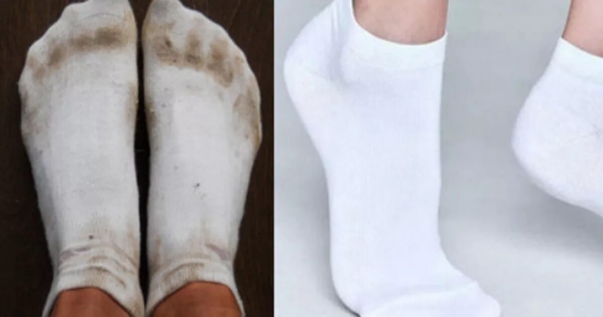Чем отстирать белые носки от черноты. Белые носки. Белые носки мужские. Отбелить носки. Отстирать белые носки.