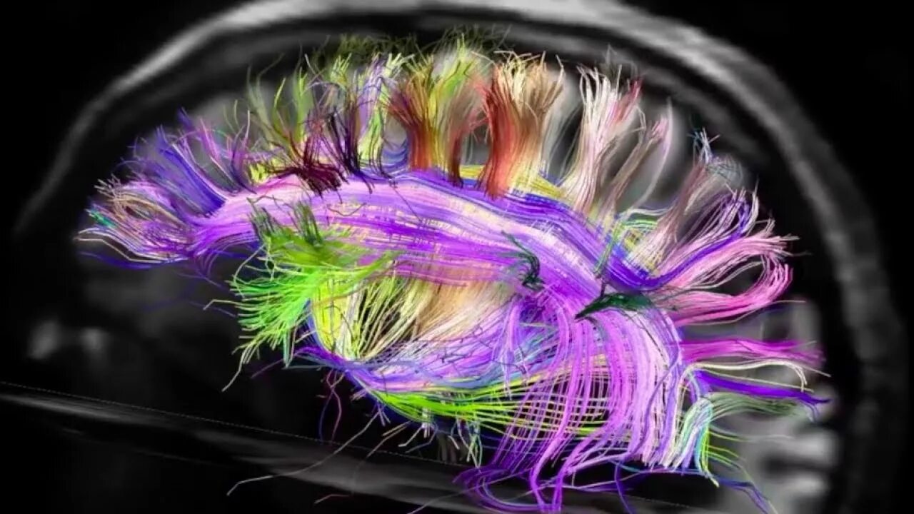 Brain is the most beautiful