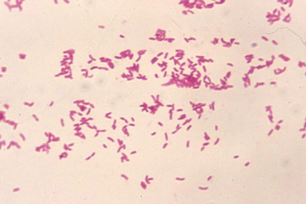 Haemophilus spp у мужчин. Ацинетобактер Баумании в мазке. Acinetobacter baumannii микроскопия. Acinetobacter микроскопия.