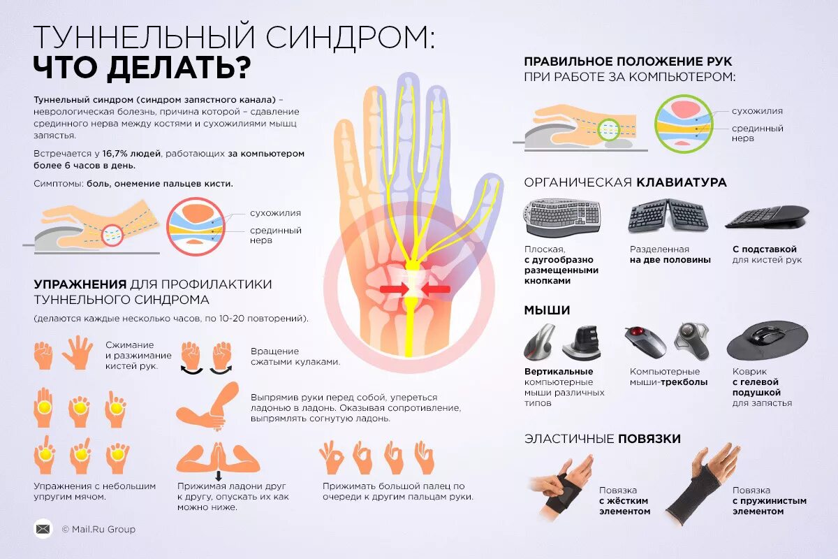 Туннельный синдром кисти. Немеет кисть правой руки причины. Синдром тональной кисти. Туннельный синдром запястья кисти