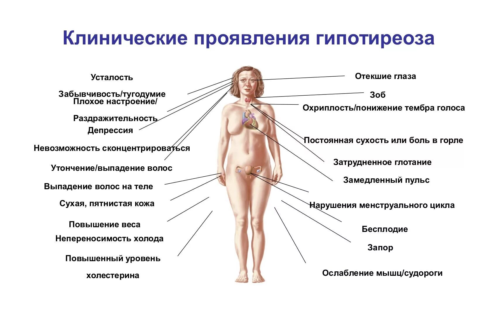 Беременность после гормонального. Щитовидная железа симптомы заболевания гипотиреоз. Основные клинические проявления гипофункции щитовидной железы. Гипотиреоз щитовидной железы симптомы. Клинические проявления гипотиреоза.